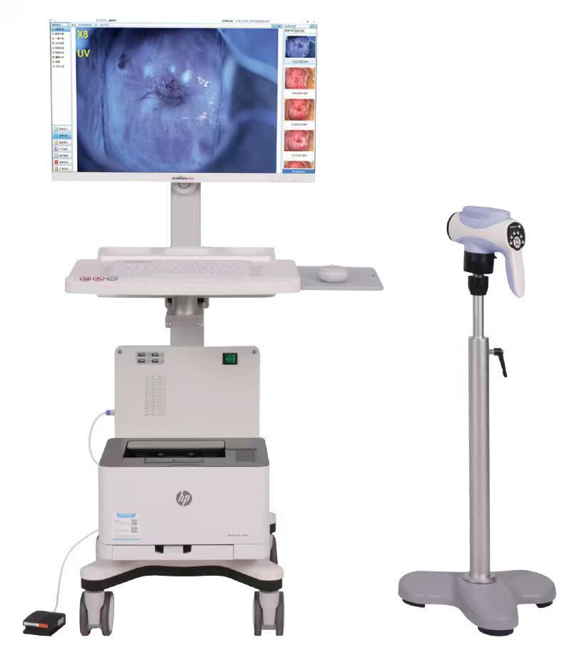 4K60b 电子阴道镜