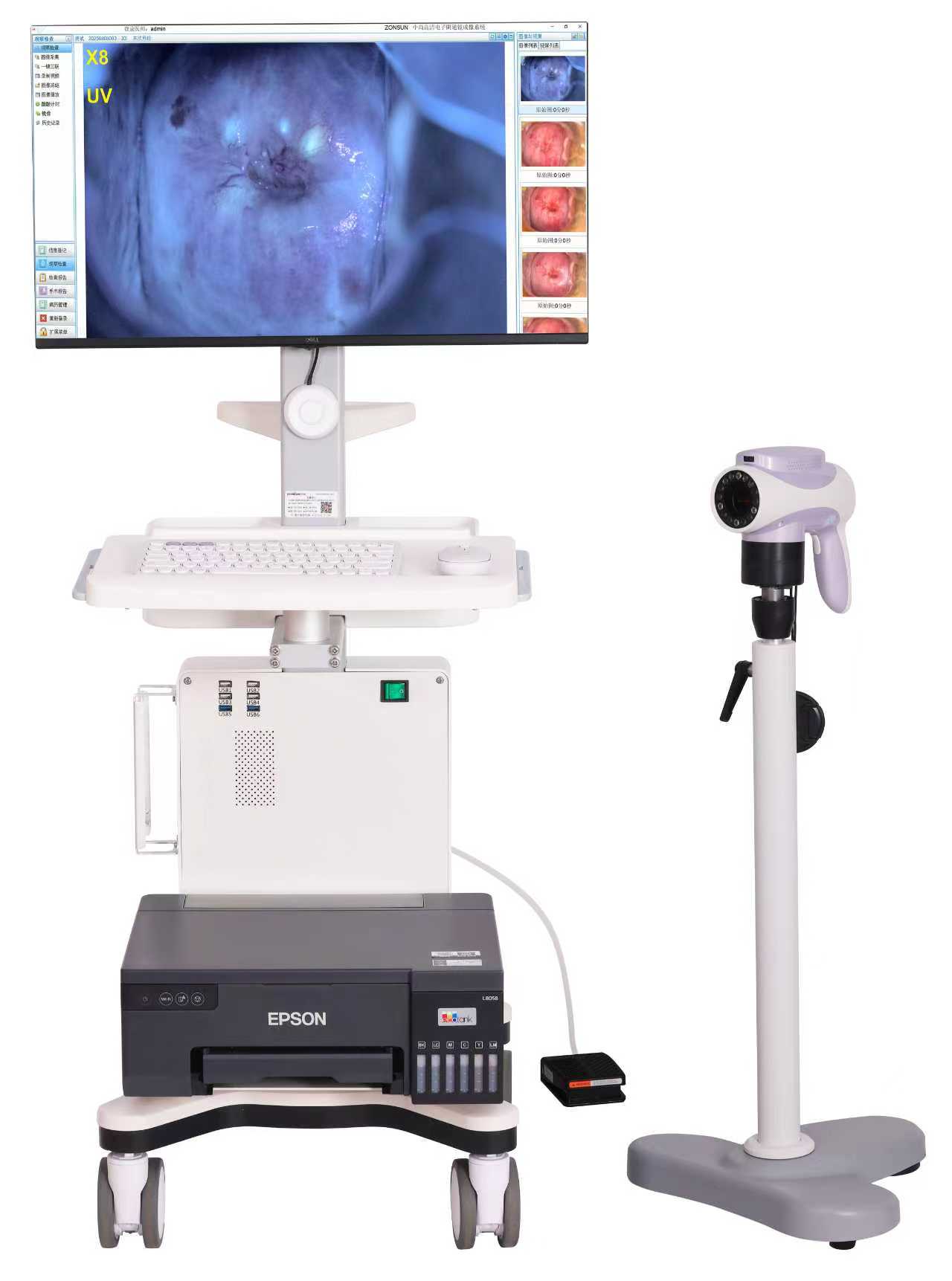 4K60b Multi-spectral UHD Colposcope